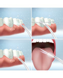 Idropulsore Dentale Ricaricabile Portatile Denter InnovaGoods